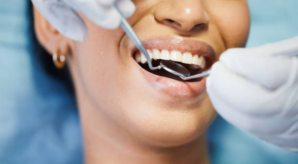 Best Urgent Dental Care for Toothache in Denton, TX