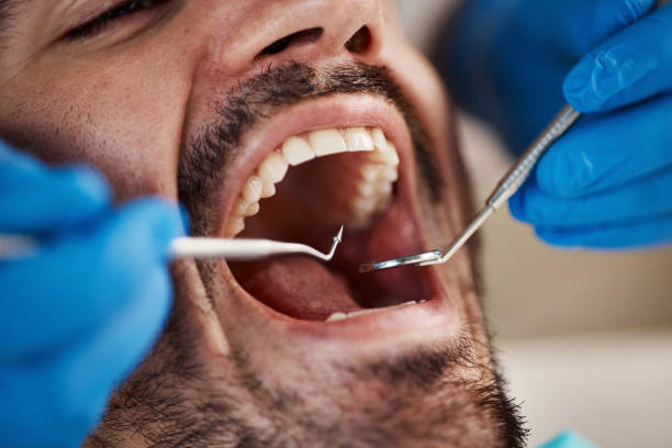 Best Pediatric Emergency Dentist in Denton, TX