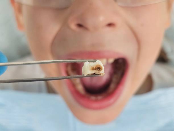 Best Mobile Emergency Dentist in Denton, TX