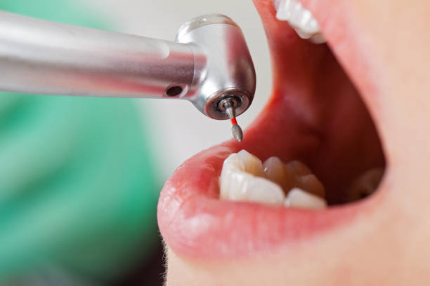 Best Holiday Emergency Dentist in Denton, TX